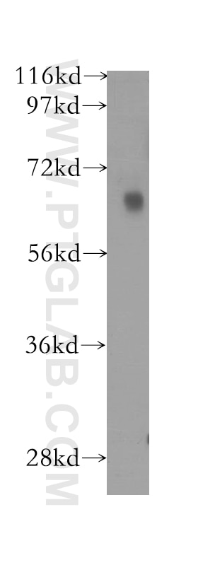 Western Blot (WB) analysis of human brain tissue using FKBP10/FKBP65 Polyclonal antibody (12172-1-AP)