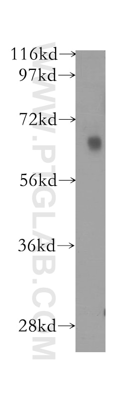 WB analysis of human brain using 12172-1-AP