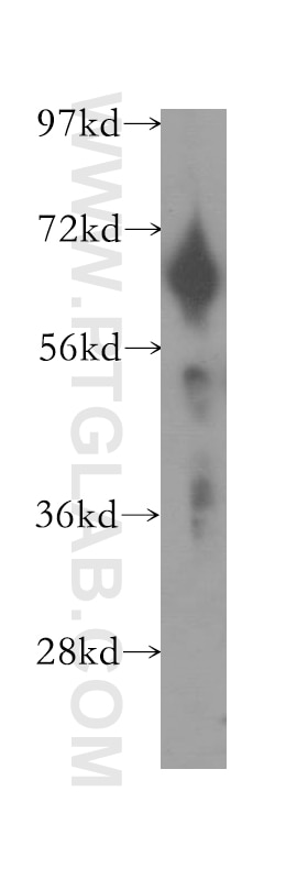 Western Blot (WB) analysis of human placenta tissue using FKBP10/FKBP65 Polyclonal antibody (12172-1-AP)