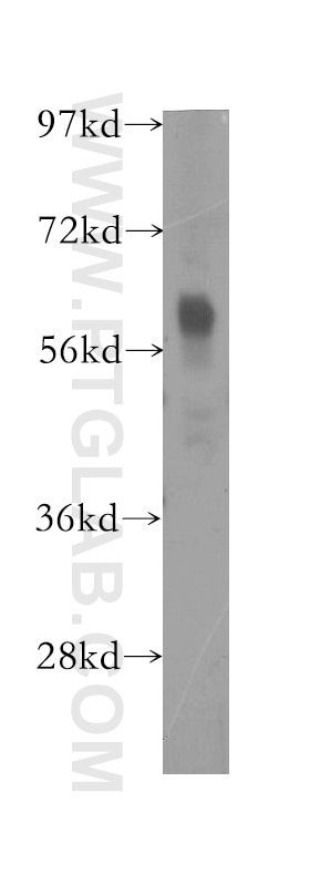Western Blot (WB) analysis of human kidney tissue using FKBP10/FKBP65 Polyclonal antibody (12172-1-AP)