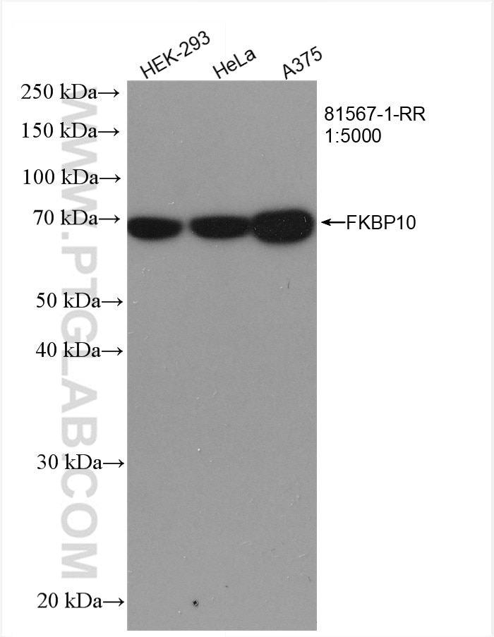 Western Blot (WB) analysis of various lysates using FKBP10/FKBP65 Recombinant antibody (81567-1-RR)