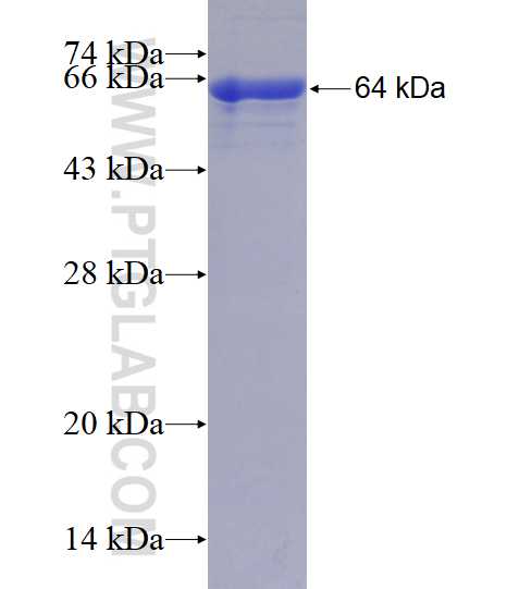 FKBP10 fusion protein Ag2814 SDS-PAGE