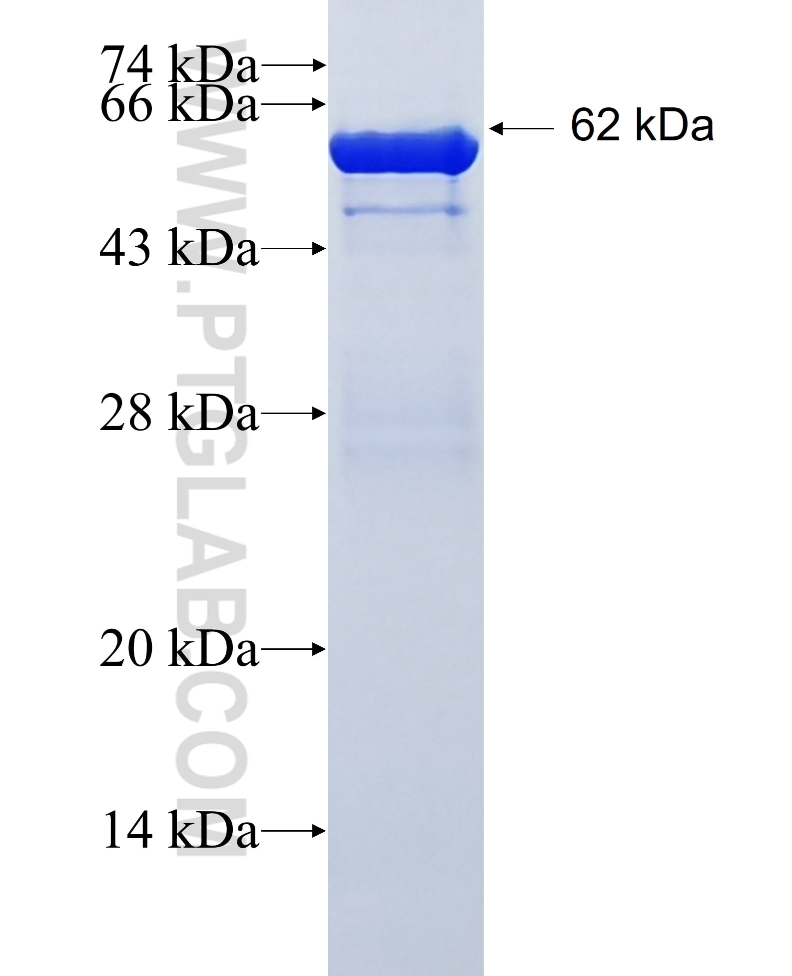 FKBP10 fusion protein Ag2814 SDS-PAGE