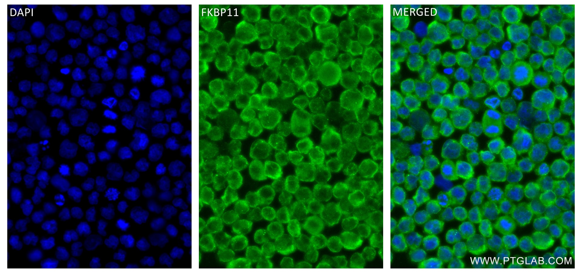 Immunofluorescence (IF) / fluorescent staining of Raji cells using FKBP11 Recombinant antibody (84478-5-RR)
