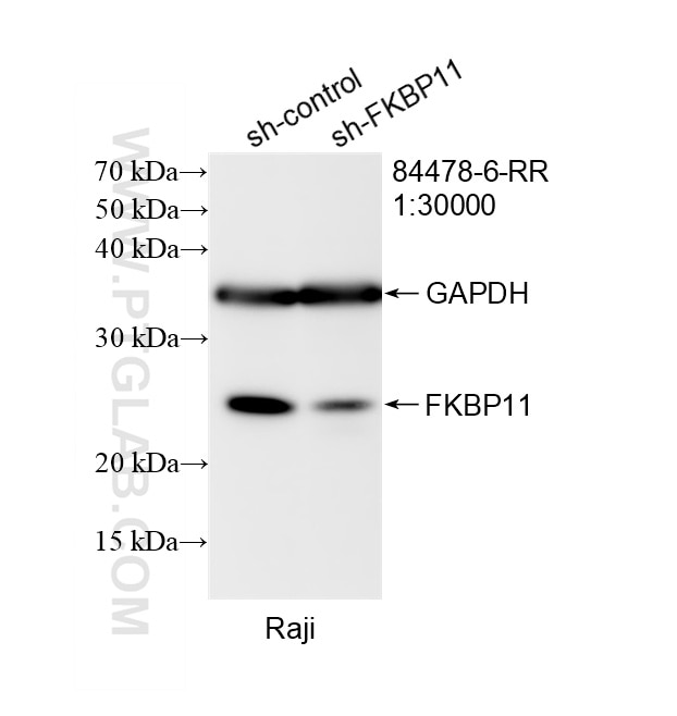 WB result of FKBP11 antibody (84478-6-RR; 1:30000; incubated at room temperature for 1.5 hours) with sh-Control and sh-FKBP11 transfected Raji cells. Western Blot (WB) analysis of Raji cells using FKBP11 Recombinant monoclonal antibody (84478-6-RR)