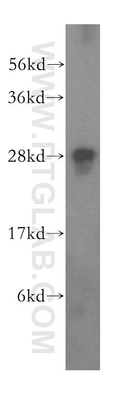Western Blot (WB) analysis of HeLa cells using FKBP14 Polyclonal antibody (15884-1-AP)