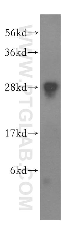 Western Blot (WB) analysis of HEK-293 cells using FKBP14 Polyclonal antibody (15884-1-AP)