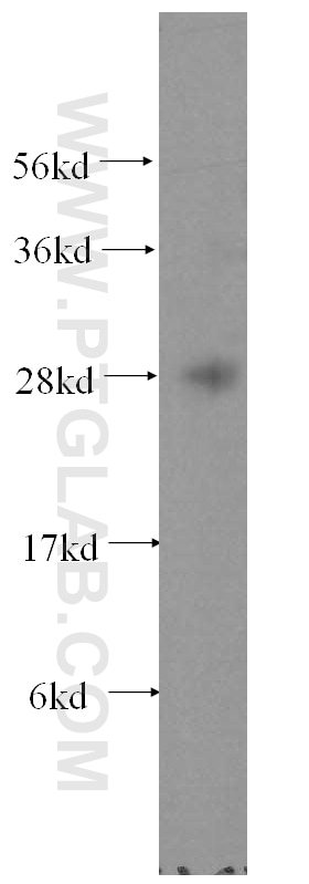 Western Blot (WB) analysis of human brain tissue using FKBP14 Polyclonal antibody (15884-1-AP)