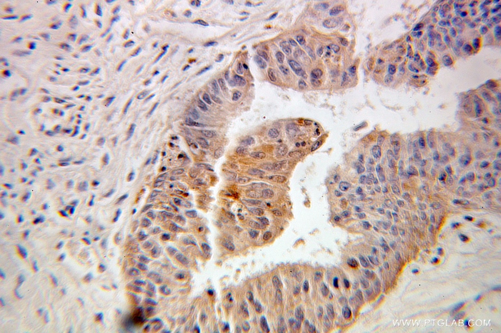 FKBP1A