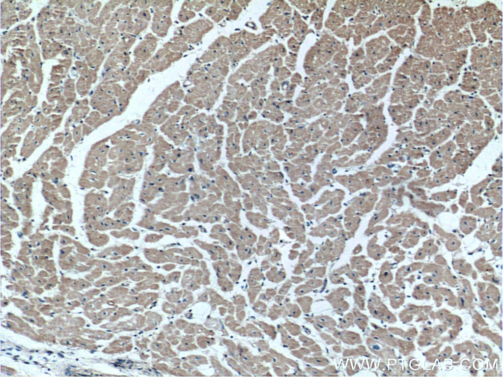 Immunohistochemistry (IHC) staining of human heart tissue using FKBP1B Polyclonal antibody (15114-1-AP)