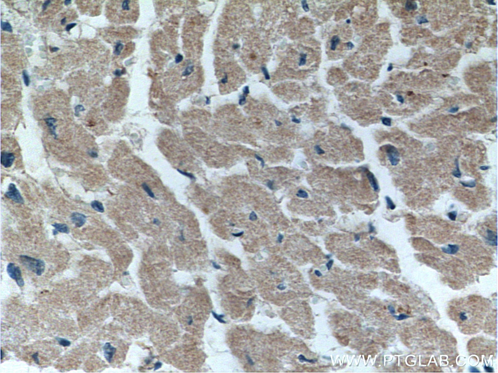 IHC staining of human heart using 15114-1-AP