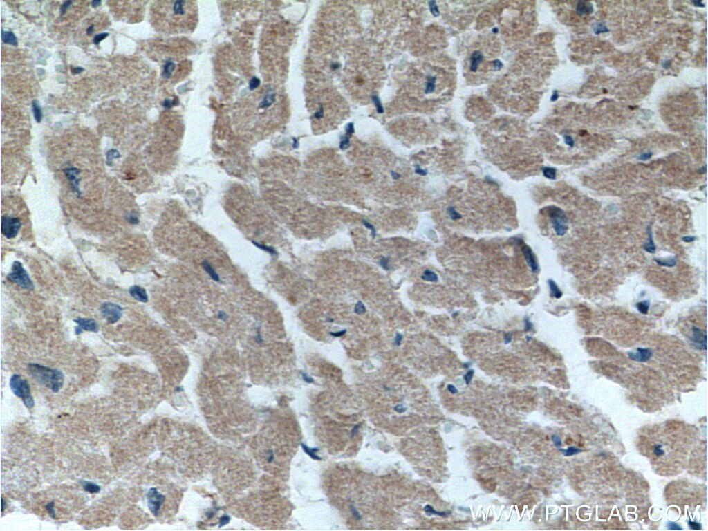 Immunohistochemistry (IHC) staining of human heart tissue using FKBP1B Polyclonal antibody (15114-1-AP)