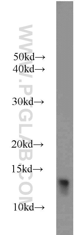 Western Blot (WB) analysis of mouse heart tissue using FKBP1B Polyclonal antibody (15114-1-AP)