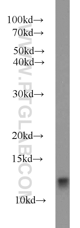 Western Blot (WB) analysis of Jurkat cells using FKBP1B Polyclonal antibody (15114-1-AP)