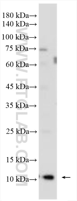Western Blot (WB) analysis of HeLa cells using FKBP2 Polyclonal antibody (11700-1-AP)
