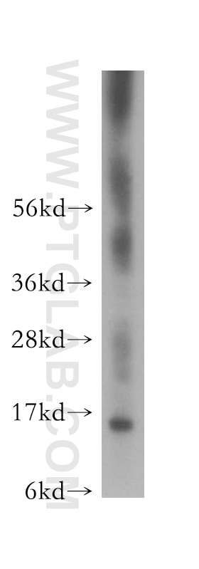 Western Blot (WB) analysis of MCF-7 cells using FKBP2 Polyclonal antibody (11700-1-AP)
