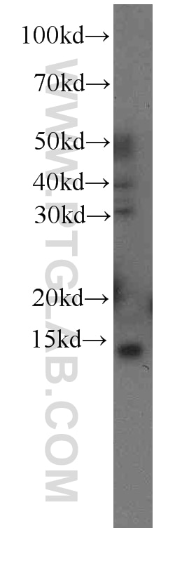 Western Blot (WB) analysis of human brain tissue using FKBP2 Monoclonal antibody (66091-1-Ig)
