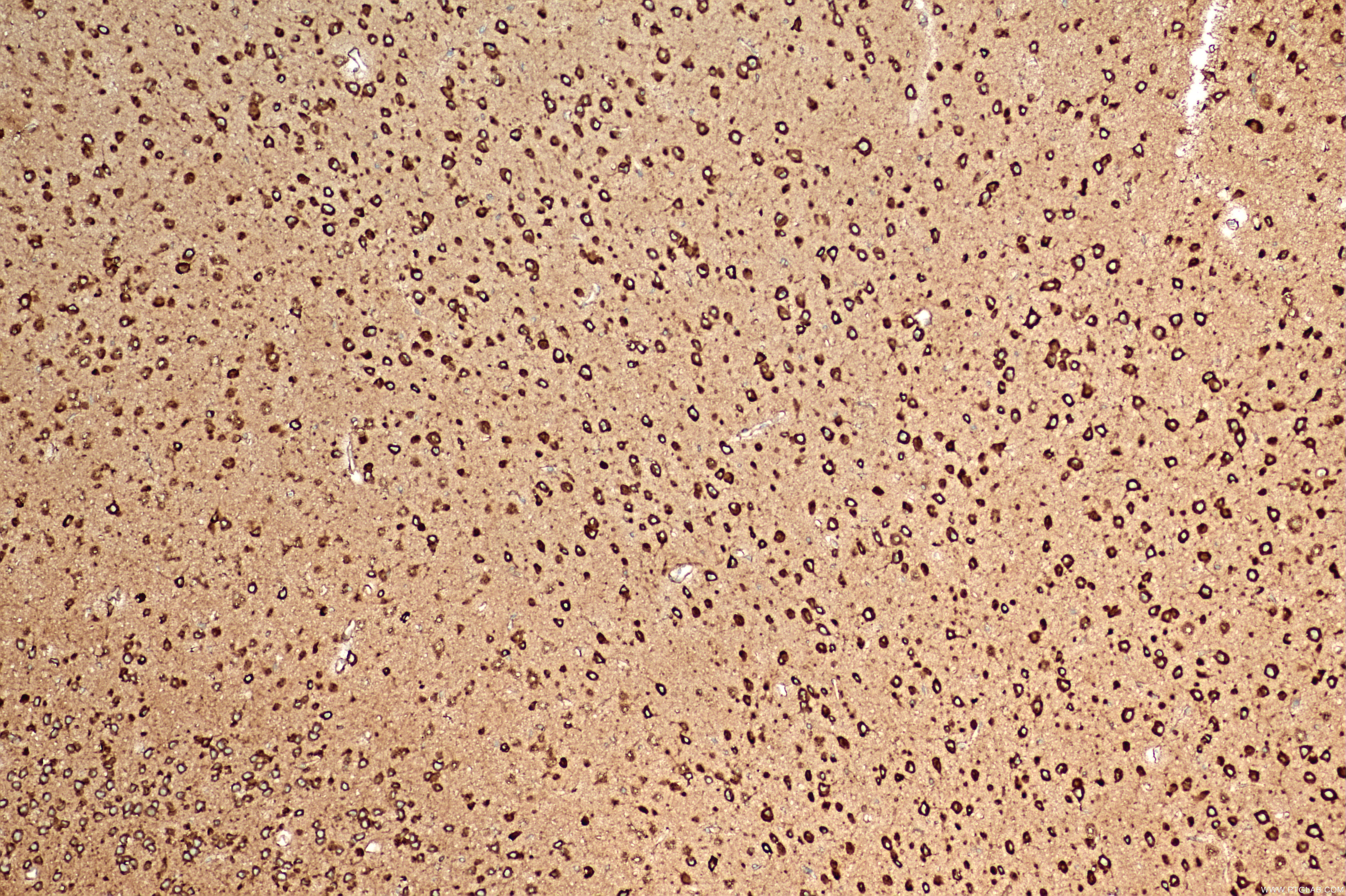 Immunohistochemistry (IHC) staining of mouse brain tissue using FKBP2 Recombinant antibody (84077-6-RR)