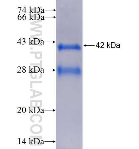 FKBP2 fusion protein Ag2255 SDS-PAGE