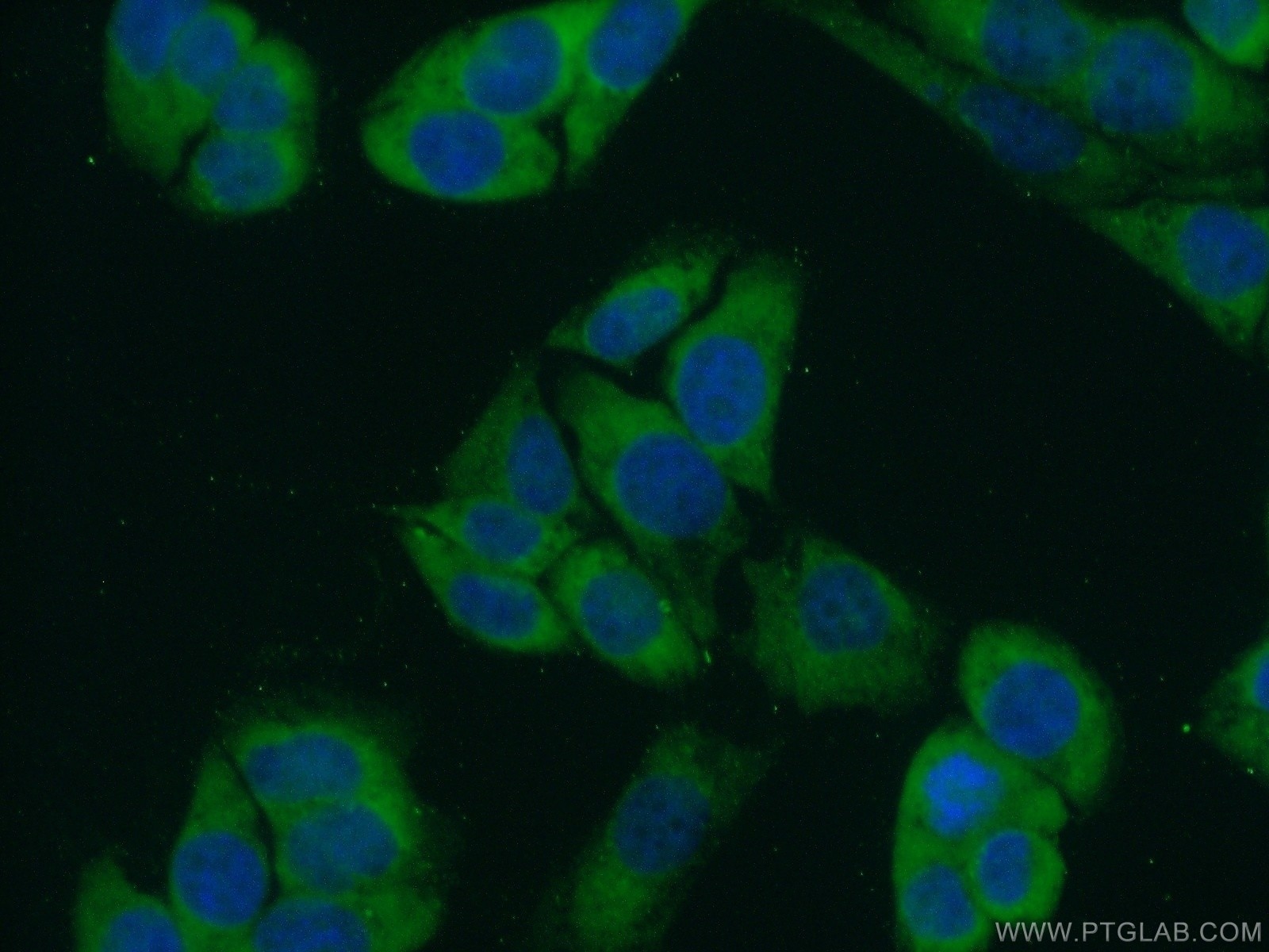 Immunofluorescence (IF) / fluorescent staining of HeLa cells using FKBP3 Polyclonal antibody (11755-1-AP)