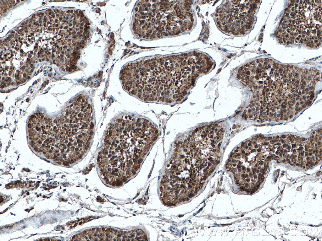 Immunohistochemistry (IHC) staining of human testis tissue using FKBP3 Polyclonal antibody (11755-1-AP)