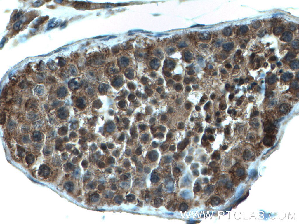 Immunohistochemistry (IHC) staining of human testis tissue using FKBP3 Polyclonal antibody (11755-1-AP)