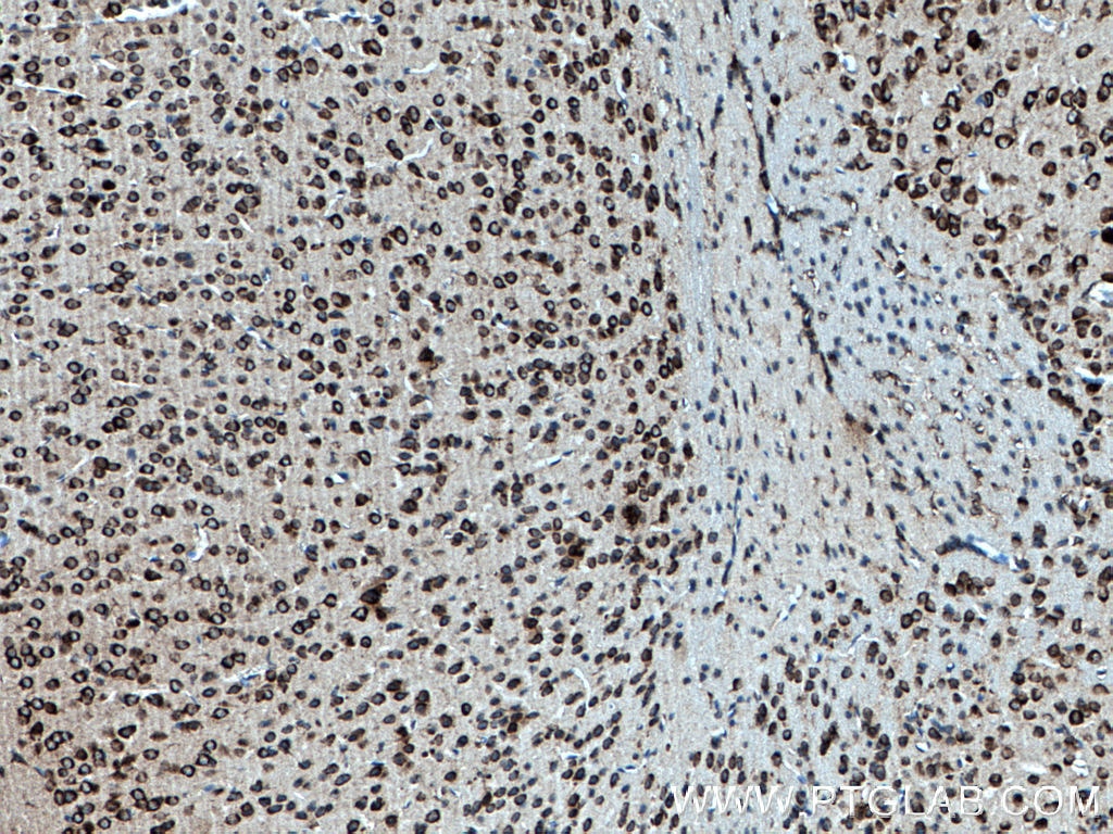 IHC staining of mouse brain using 11755-1-AP