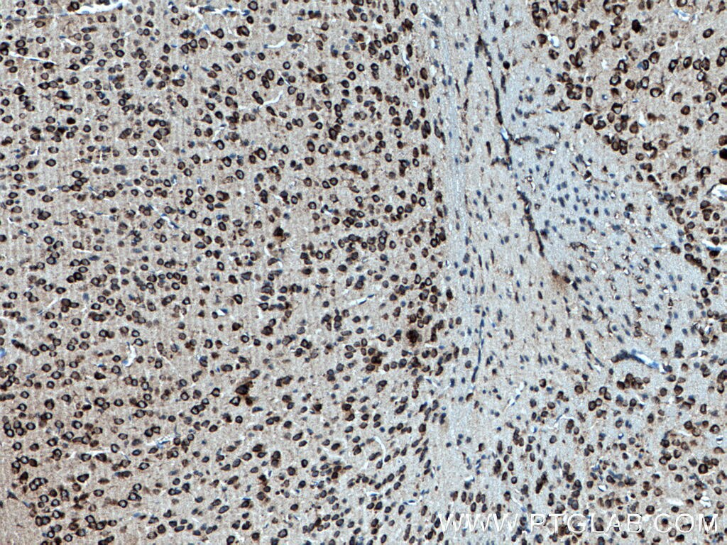 Immunohistochemistry (IHC) staining of mouse brain tissue using FKBP3 Polyclonal antibody (11755-1-AP)