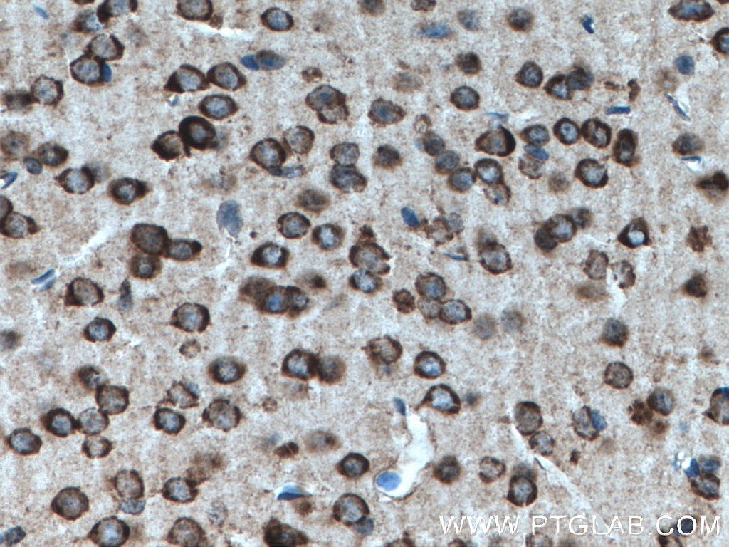 Immunohistochemistry (IHC) staining of mouse brain tissue using FKBP3 Polyclonal antibody (11755-1-AP)