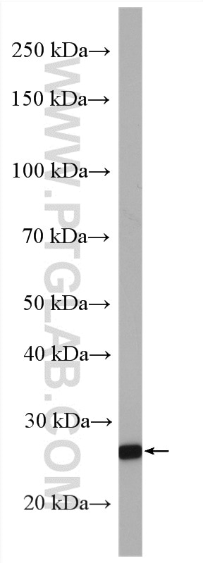 WB analysis of PC-3 using 11755-1-AP