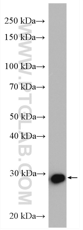 Western Blot (WB) analysis of HeLa cells using FKBP3 Polyclonal antibody (11755-1-AP)