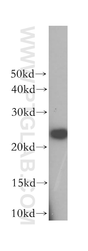 Western Blot (WB) analysis of A431 cells using FKBP3 Polyclonal antibody (11755-1-AP)