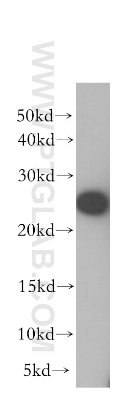 Western Blot (WB) analysis of PC-3 cells using FKBP3 Polyclonal antibody (11755-1-AP)