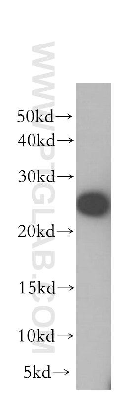 WB analysis of PC-3 using 11755-1-AP
