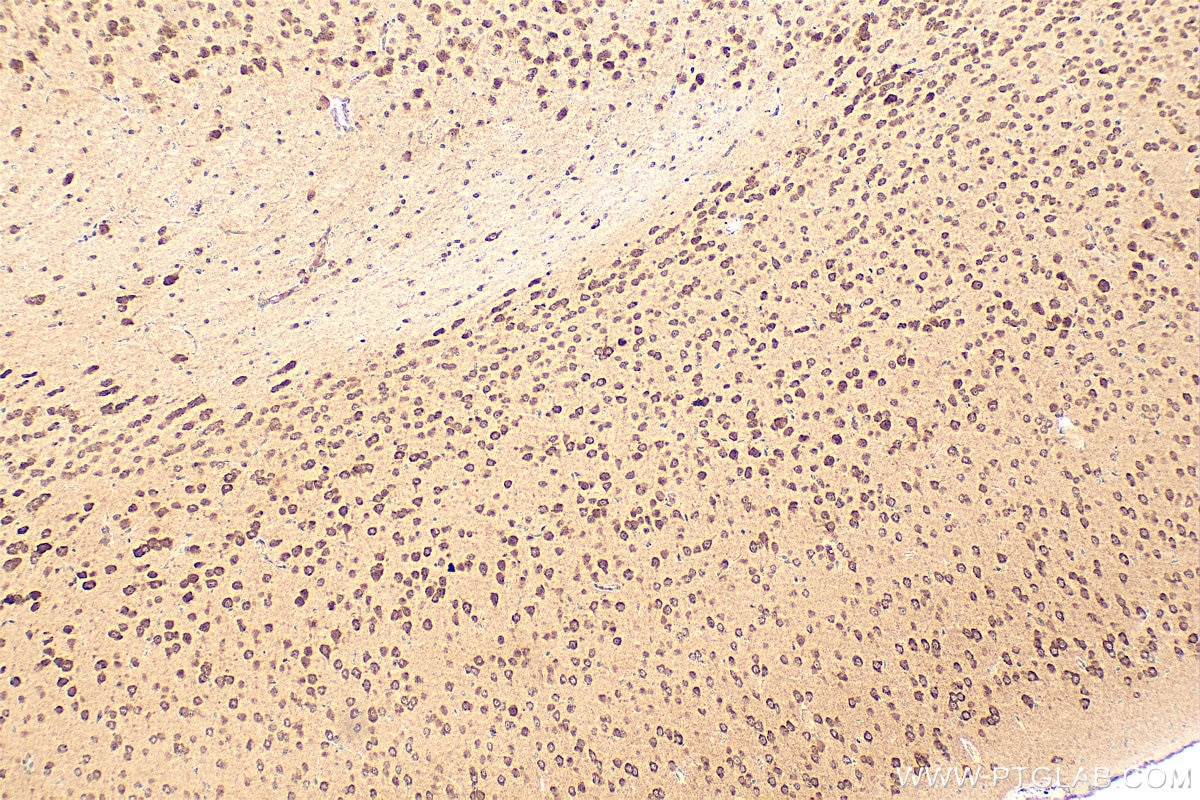 Immunohistochemistry (IHC) staining of mouse brain tissue using FKBP5 Polyclonal antibody (14155-1-AP)