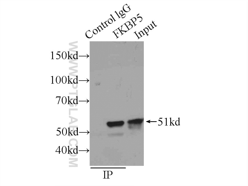 Immunoprecipitation (IP) experiment of K-562 cells using FKBP5 Polyclonal antibody (14155-1-AP)