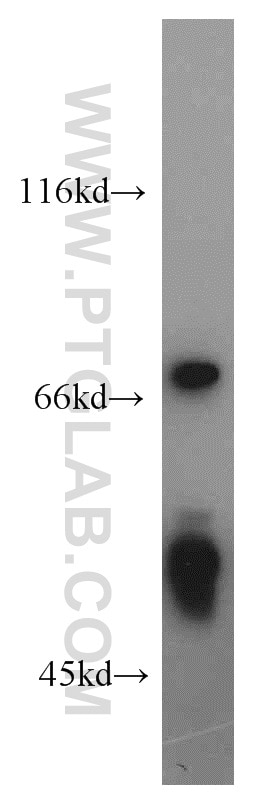 Western Blot (WB) analysis of mouse thymus tissue using FKBP5 Polyclonal antibody (14155-1-AP)