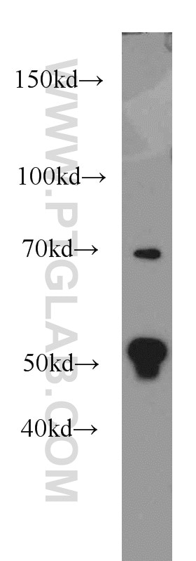 Western Blot (WB) analysis of mouse thymus tissue using FKBP5 Polyclonal antibody (14155-1-AP)