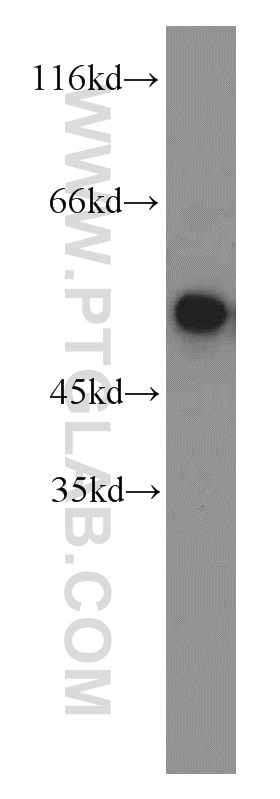 Western Blot (WB) analysis of K-562 cells using FKBP5 Polyclonal antibody (14155-1-AP)