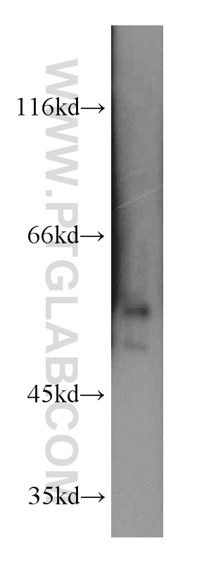 Western Blot (WB) analysis of HEK-293 cells using FKBP5 Polyclonal antibody (14155-1-AP)