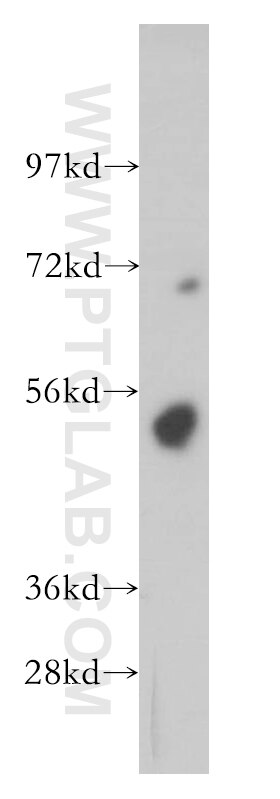 Western Blot (WB) analysis of mouse thymus tissue using FKBP5 Polyclonal antibody (14155-1-AP)