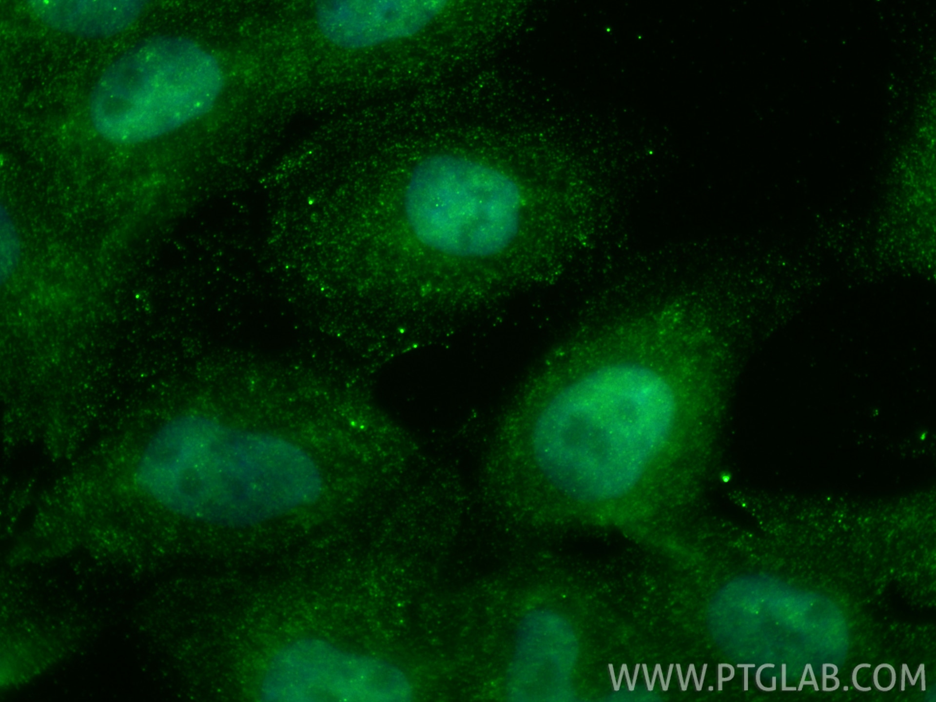 Immunofluorescent analysis of (4% PFA) fixed A431 cells using FKBP5 antibody (67874-1-Ig, Clone: 3B11F3 ) at dilution of 1:400 and CoraLite®488-Conjugated Goat Anti-Mouse IgG(H+L) (SA00013-1). Immunofluorescence (IF) / fluorescent staining of A431 cells using FKBP5 Monoclonal antibody (67874-1-Ig)