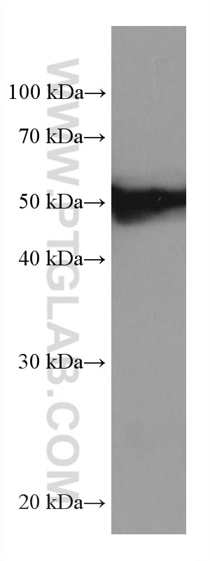 Western Blot (WB) analysis of mouse testis tissue using FKBP5 Monoclonal antibody (67874-1-Ig)