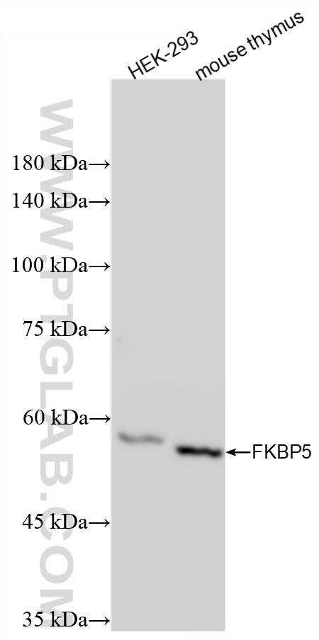 Western Blot (WB) analysis of various lysates using FKBP5 Recombinant monoclonal antibody (86189-1-RR)