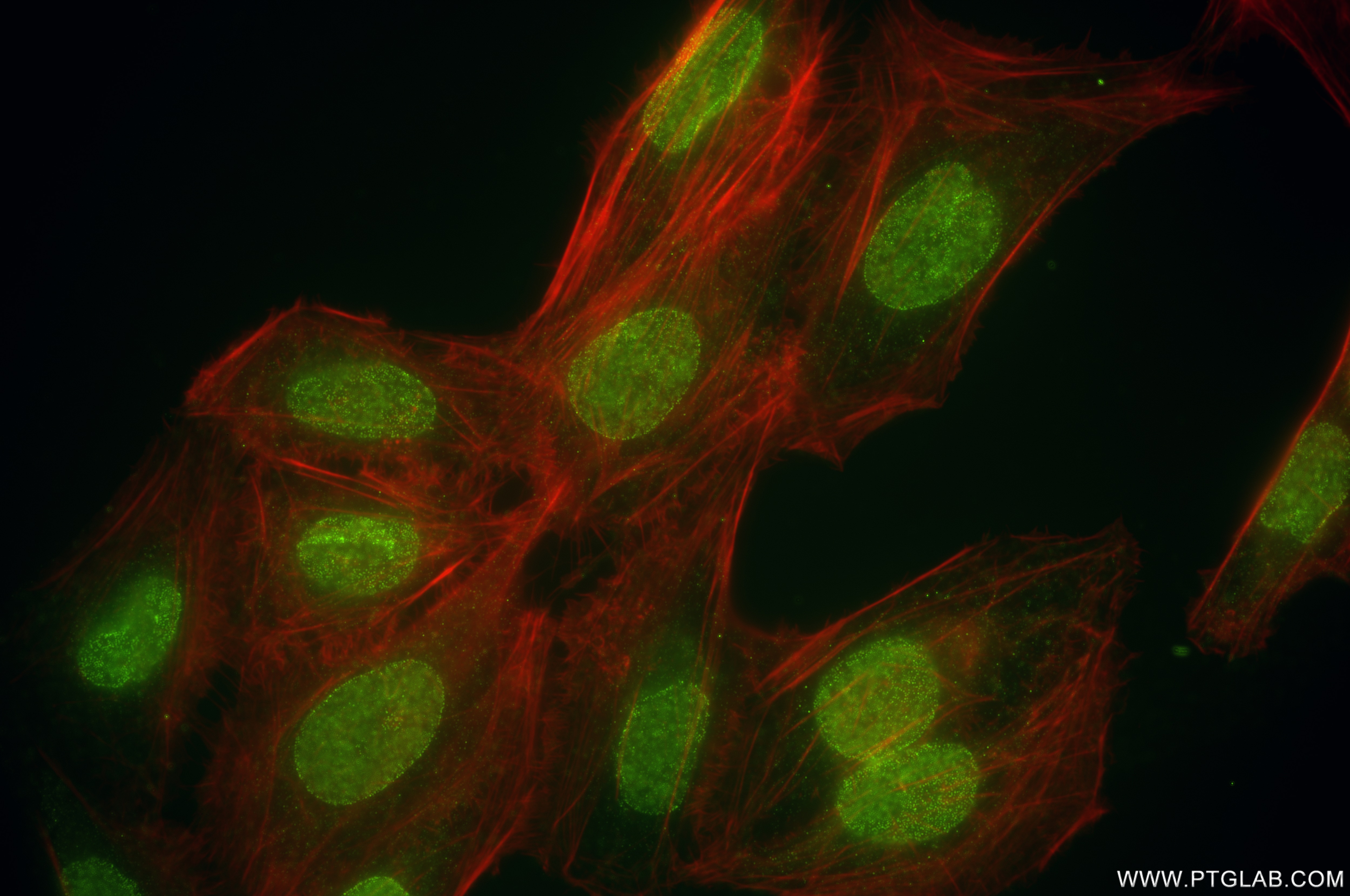Immunofluorescence (IF) / fluorescent staining of U2OS cells using FKBP5 Recombinant monoclonal antibody (86189-2-RR)
