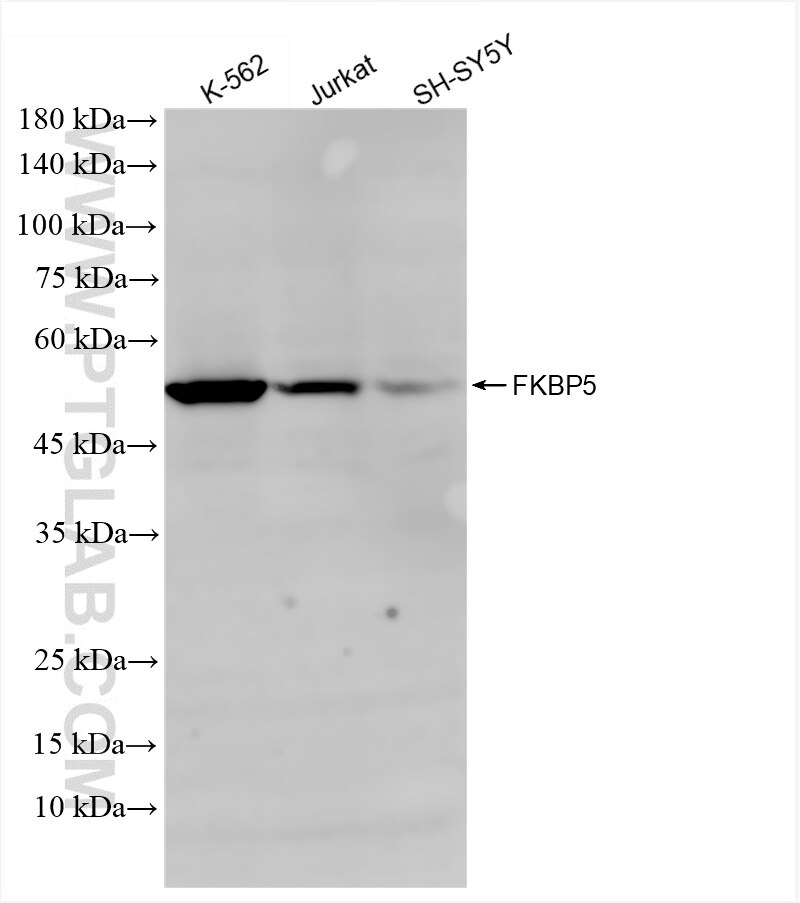Western Blot (WB) analysis of various lysates using FKBP5 Recombinant antibody (86189-2-RR)