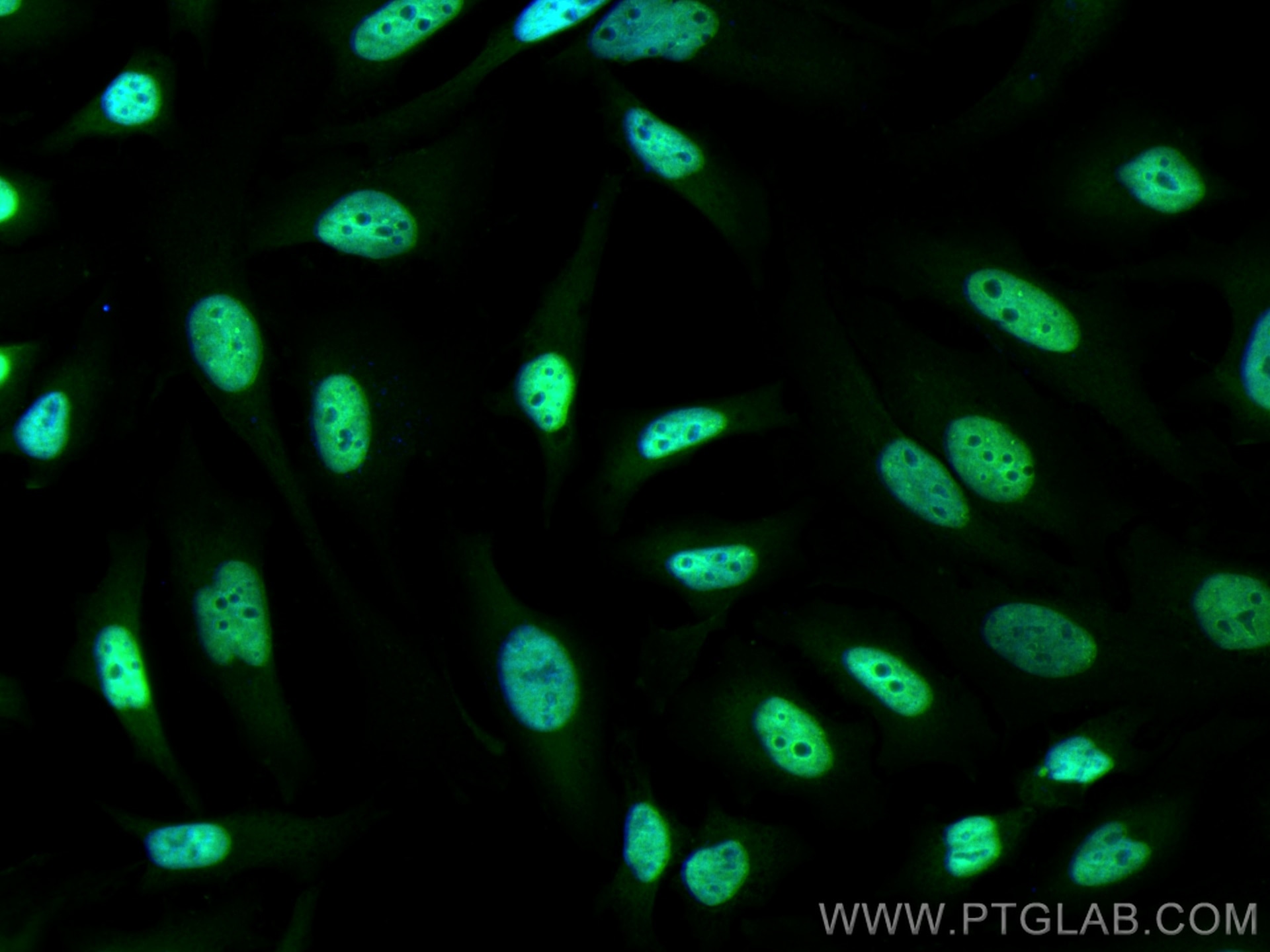Immunofluorescence (IF) / fluorescent staining of HeLa cells using CoraLite® Plus 488-conjugated FKBP5 Monoclonal ant (CL488-67874)