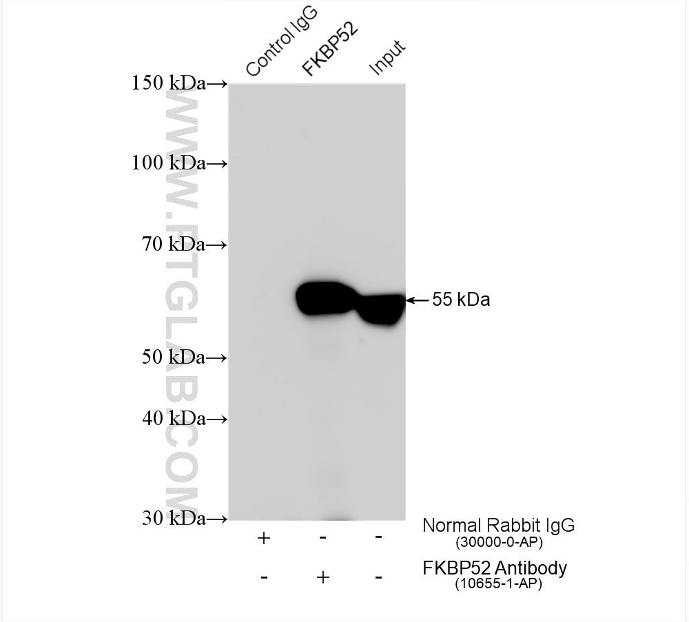 Immunoprecipitation (IP) experiment of HeLa cells using FKBP52 Polyclonal antibody (10655-1-AP)