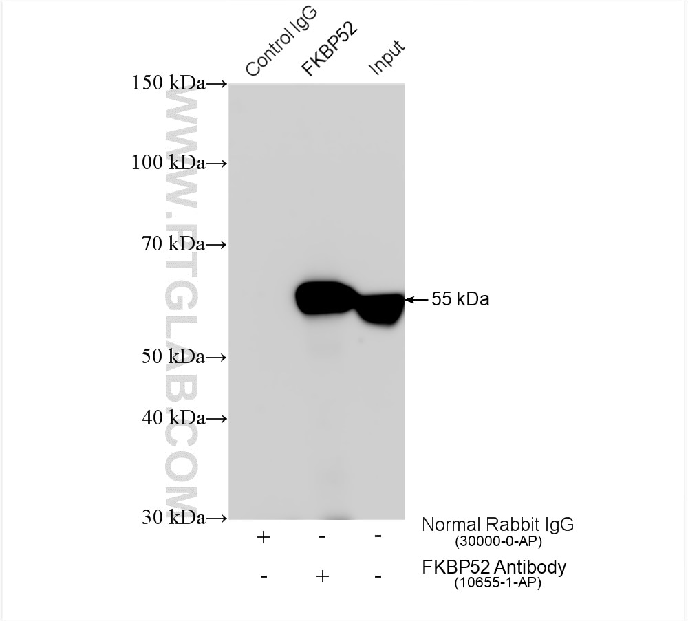 IP experiment of HeLa using 10655-1-AP