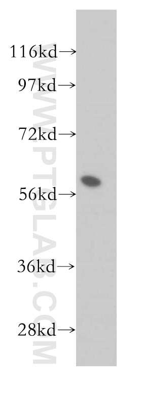 Western Blot (WB) analysis of PC-3 cells using FKBP52 Polyclonal antibody (10655-1-AP)